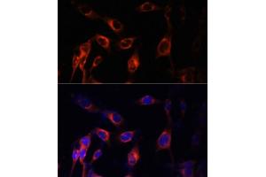 Immunofluorescence analysis of NIH-3T3 cells using TSC1 Polyclonal Antibody (ABIN6133755, ABIN6149609, ABIN6149610 and ABIN6213968) at dilution of 1:100 (40x lens). (TSC1 抗体  (AA 550-650))