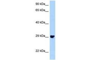 Image no. 1 for anti-Pleckstrin Homology Domain Containing, Family F (With FYVE Domain) Member 2 (PLEKHF2) (N-Term) antibody (ABIN6748203)