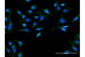Immunofluorescence of purified MaxPab antibody to SPO11 on HeLa cell. (SPO11 抗体  (AA 1-358))