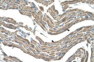 Image no. 1 for anti-Asporin (ASPN) (AA 250-299) antibody (ABIN203462) (Asporin 抗体  (AA 250-299))