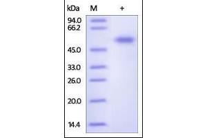 SDS-PAGE (SDS) image for Frizzled Family Receptor 7 (FZD7) (AA 33-185) protein (Fc Tag) (ABIN2181130) (FZD7 Protein (AA 33-185) (Fc Tag))