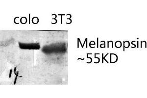 Western blot analysis of various lysates using Melanopsin Polyclonal Antibody. (OPN4 抗体  (AA 400-480))