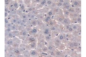 Immunohistochemistry (IHC) image for anti-N-Acetyltransferase 1 (Arylamine N-Acetyltransferase) (NAT1) (AA 9-254) antibody (ABIN7436222)