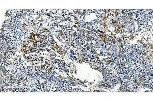 IHC analysis of TMBIM1 using anti-TMBIM1 antibody (ABIN7603190). (TMBIM1 抗体  (N-Term))
