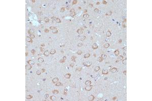 Immunohistochemistry of paraffin-embedded mouse brain using COPG2 antibody (ABIN7266426) at dilution of 1:100 (40x lens). (COPG2 抗体  (AA 542-871))