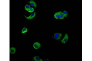 Immunofluorescence staining of MCF-7 cells with ABIN7161114 at 1:133, counter-stained with DAPI. (PVRL4 抗体  (AA 91-199))