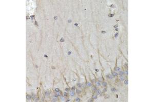 Immunohistochemistry (IHC) image for anti-Proteasome (Prosome, Macropain) Subunit, beta Type 10 (PSMB10) (AA 1-273) antibody (ABIN6146311)