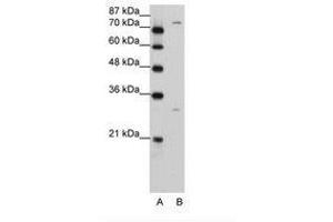 Image no. 2 for anti-Prostaglandin-Endoperoxide Synthase 1 (Prostaglandin G/H Synthase and Cyclooxygenase) (PTGS1) (AA 51-100) antibody (ABIN203401) (PTGS1 抗体  (AA 51-100))