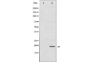 Western blot analysis of Stathmin 1 phosphorylation expression in PMA treated Jurkat whole cell lysates,The lane on the left is treated with the antigen-specific peptide. (Stathmin 1 抗体  (pSer25))