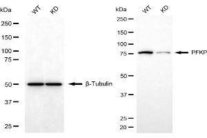 Western blotting analysis using PFKP antibody (ABIN7799803). (PFKP 抗体)