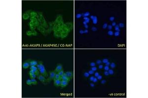 IF/ICC testing of fixed and permeabilized human A431 cells with AKAP9 antibody (green) at 10ug/ml and DAPI nuclear stain (blue). (AKAP9 抗体)