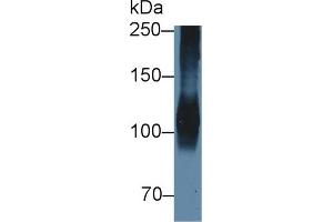 Detection of ATP1a1 in Porcine Cerebrum lysate using Polyclonal Antibody to ATPase, Na+/K+ Transporting Alpha 1 Polypeptide (ATP1a1) (ATP1A1 抗体  (AA 493-660))