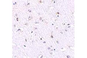 Immunohistochemical staining of human brain tissue with 2. (Nanos Homolog 1 抗体  (N-Term))