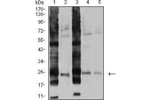 Western Blotting (WB) image for anti-V-Ral Simian Leukemia Viral Oncogene Homolog B (Ras Related, GTP Binding Protein) (Ralb) (AA 89-206) antibody (ABIN5542684)