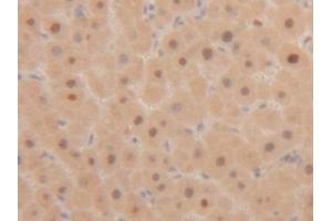 Immunohistochemistry (IHC) image for anti-Proliferating Cell Nuclear Antigen (PCNA) (AA 6-261) antibody (ABIN7443113)