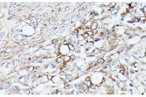 Immunohistochemistry (Paraffin-embedded Sections) (IHC (p)) image for anti-Acetyl-CoA Acetyltransferase 2 (ACAT2) antibody (ABIN7263895)
