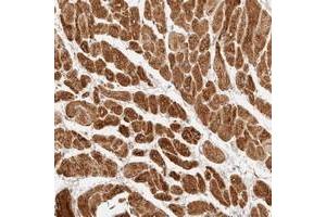 Immunohistochemical staining of human heart muscle with TRIM11 polyclonal antibody  shows strong cytoplasmic positivity in myocytes at 1:20-1:50 dilution. (TRIM11 抗体)