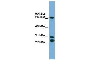 Western Blot showing DNAI2 antibody used at a concentration of 1-2 ug/ml to detect its target protein. (DNAI2 抗体  (N-Term))