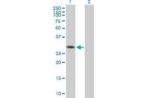 Western Blot analysis of SIP1 expression in transfected 293T cell line by SIP1 MaxPab polyclonal antibody. (SIP1 抗体  (AA 1-280))