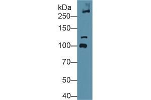 Western Blot; Sample: Mouse Bladder lysate; Primary Ab: 1µg/ml Rabbit Anti-Mouse COL6a3 Antibody Second Ab: 0. (COL6a3 抗体  (AA 2009-2205))