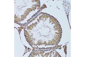 Immunohistochemistry (Paraffin-embedded Sections) (IHC (p)) image for anti-Ribophorin 1 (RPN1) (AA 20-280) antibody (ABIN6147170)