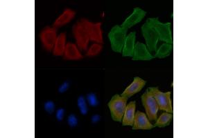 ABIN6258651 and ABIN6275383 staining Hela cells(30 min of UV treatment) by IF/ICC.