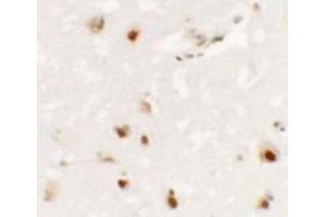 Immunohistochemistry of SHANK3 in human brain tissue with SHANK3 antibody at 2. (SHANK3 抗体  (Middle Region))