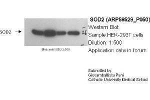 Western Blotting (WB) image for anti-Superoxide Dismutase 2, Mitochondrial (SOD2) (N-Term) antibody (ABIN2787727) (SOD2 抗体  (N-Term))