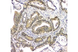 IHC analysis of EIF6 using anti-EIF6 antibody (ABIN6719594). (EIF6 抗体  (AA 66-210))