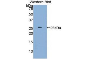 Western Blotting (WB) image for anti-Orosomucoid 2 (ORM2) (AA 19-207) antibody (ABIN1175013) (Orosomucoid 2 抗体  (AA 19-207))