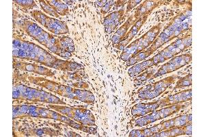 ABIN7094702 and ABIN7098753 at 1/100 staining Rat colorectal tissue by IHC-P. (SET/TAF-I 抗体  (N-Term))