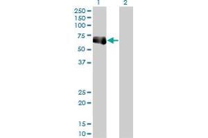 Western Blot analysis of TRIM9 expression in transfected 293T cell line by TRIM9 monoclonal antibody (M01), clone 1F12.