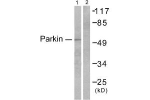 Western blot analysis of extracts from Jukat cells, using Parkin antibody (ABIN5976483). (Parkin 抗体  (N-Term))