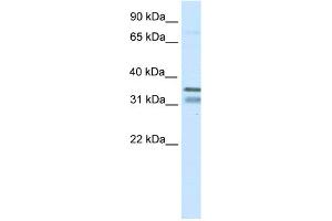 WB Suggested Anti-NKX2-2 Antibody Titration:  0. (Nkx2-2 抗体  (N-Term))