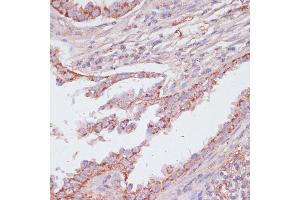 Immunohistochemistry (IHC) image for anti-ATP Synthase, H+ Transporting, Mitochondrial F1 Complex, gamma Polypeptide 1 (ATP5C1) (AA 26-298) antibody (ABIN7265723)