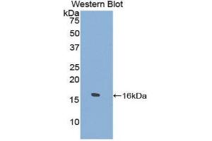 Western Blotting (WB) image for anti-Tryptase delta 1 (TPSD1) (AA 99-191) antibody (ABIN1860851) (TPSD1 抗体  (AA 99-191))