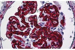 Human Kidney, Glomeruli: Formalin-Fixed, Paraffin-Embedded (FFPE) (CD34 抗体)