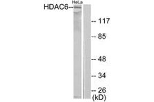Western blot analysis of extracts from HeLa cells, using HDAC6 Antibody. (HDAC6 抗体  (AA 1166-1215))