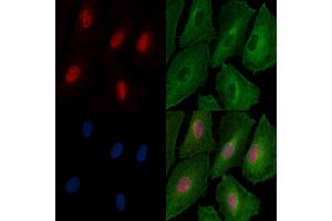 Phospho-FOXL2 (Ser263) Antibody staining A549 cells(4h of LPS treatment) by IF/ICC.