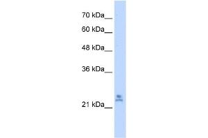 WB Suggested Anti-MRPS15 Antibody Titration:  2. (MRPS15 抗体  (C-Term))