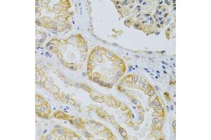 Immunohistochemistry (Paraffin-embedded Sections) (IHC (p)) image for anti-ATP-Binding Cassette, Sub-Family C (CFTR/MRP), Member 1 (ABCC1) antibody (ABIN3017211)