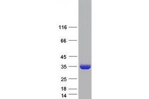 Western Blotting (WB) image for Ketohexokinase (KHK) (Transcript Variant B) protein (Myc-DYKDDDDK Tag) (ABIN2724149)