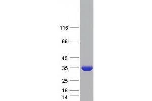 Validation with Western Blot (Ketohexokinase Protein (KHK) (Transcript Variant B) (Myc-DYKDDDDK Tag))