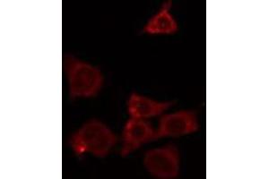 ABIN6266628 staining HeLa by IF/ICC. (RASH/RASK/RASN 抗体)