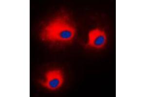 Immunofluorescent analysis of PKC theta (pS676) staining in HeLa cells. (PKC theta 抗体  (C-Term, pSer676))