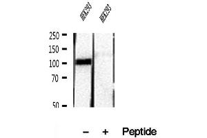 Western blot analysis of extracts of HEK293 cells, using RBM15 antibody.