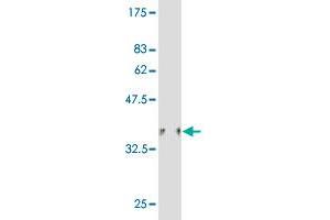 Western Blot detection against Immunogen (36. (HIPK1 抗体  (AA 330-430))