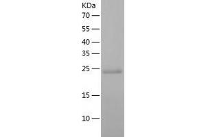 Western Blotting (WB) image for DiGeorge Syndrome Critical Region Gene 6-Like (DGCR6L) (AA 1-220) protein (His tag) (ABIN7288667) (DGCR6L Protein (AA 1-220) (His tag))