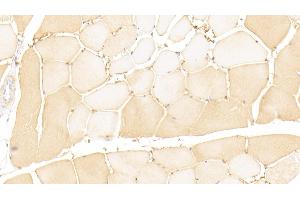 Detection of GTF2H1 in Human Skeletal muscle Tissue using Polyclonal Antibody to General Transcription Factor IIH Subunit 1 (GTF2H1) (GTF2H1 抗体  (AA 84-335))