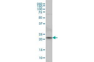 NKIRAS2 monoclonal antibody (M02), clone 2G9 Western Blot analysis of NKIRAS2 expression in HeLa . (NKIRAS2 抗体  (AA 1-191))